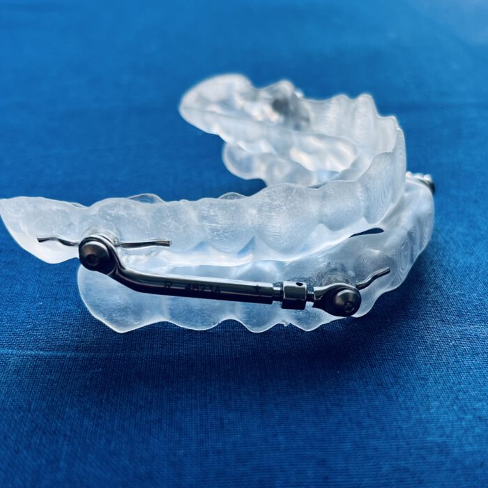 Schnarchschiene – Effektive Hilfe gegen Schnarchen